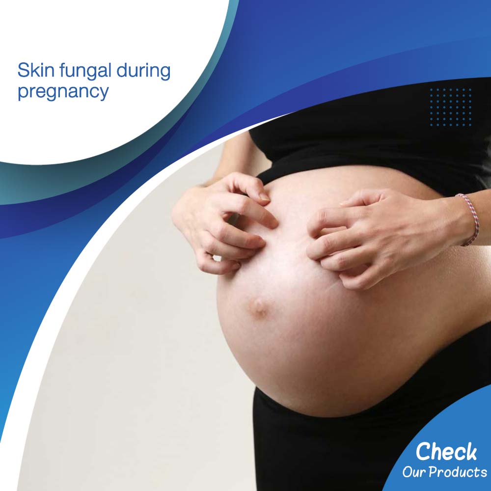 Skin fungal during pregnancy - Life Care Pharmacy