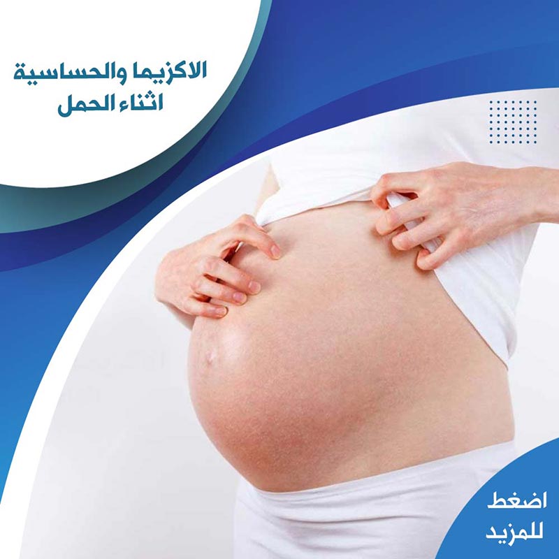 الاكزيما والحساسية اثناء الحمل - صيدلية لايف كير