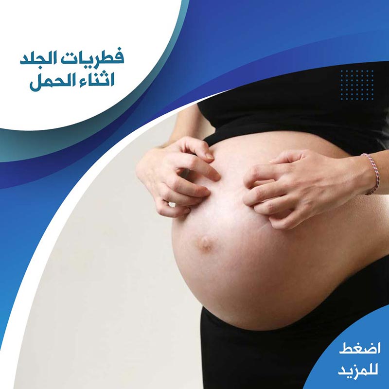 فطريات الجلد اثناء الحمل - صيدلية لايف كير