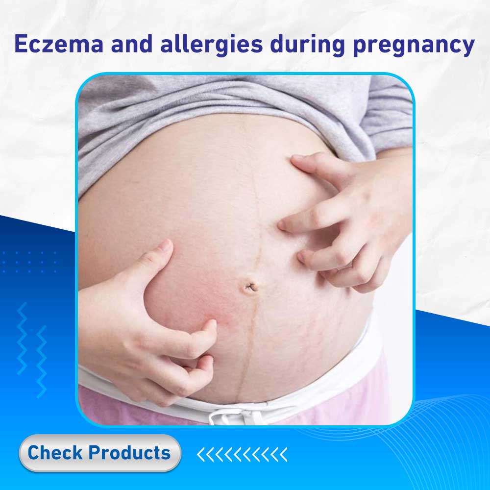 Eczema and allergies during pregnancy - Life Care Pharmacy